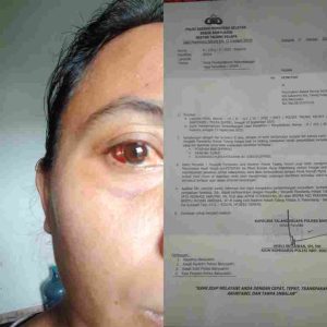 Dianiaya Tetangga, Ibu Rumah Tangga di Banyuasin Alami Trauma Berat — Laporan ke Polisi Jalan di Tempat