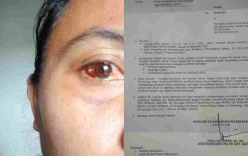 Dianiaya Tetangga, Ibu Rumah Tangga di Banyuasin Alami Trauma Berat — Laporan ke Polisi Jalan di Tempat