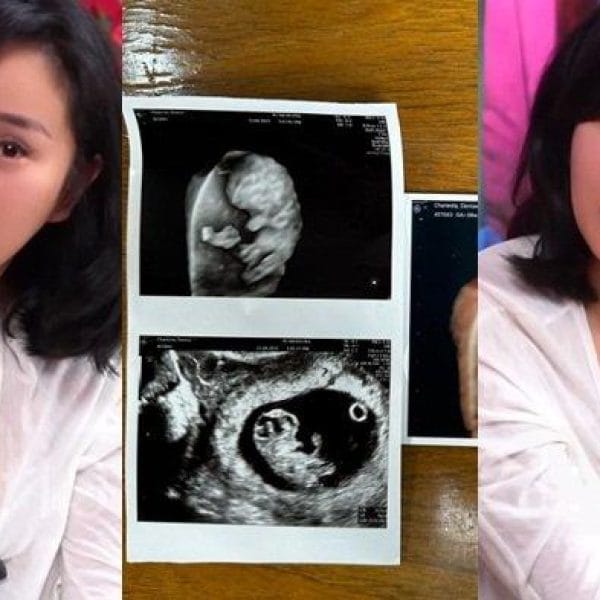 Terbongkar! Sempat Ngemis Donasi Biaya Lahiran, Kehamilan Denise Chariesta Ternyata Cuma Bohongan?