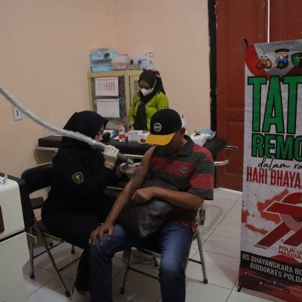 Polres Situbondo Beri Layanan Hapus Tato Gratis di Hari Bhayangkara ke -79